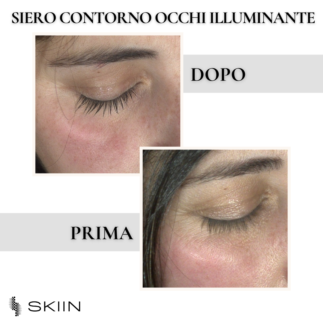 SIERO CONTORNO OCCHI ILLUMINANTE