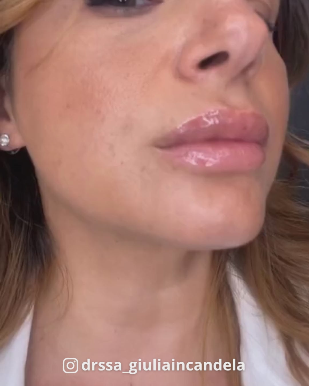 Scopri Lip Plump Effetto Filler, Labbra Più Voluminose