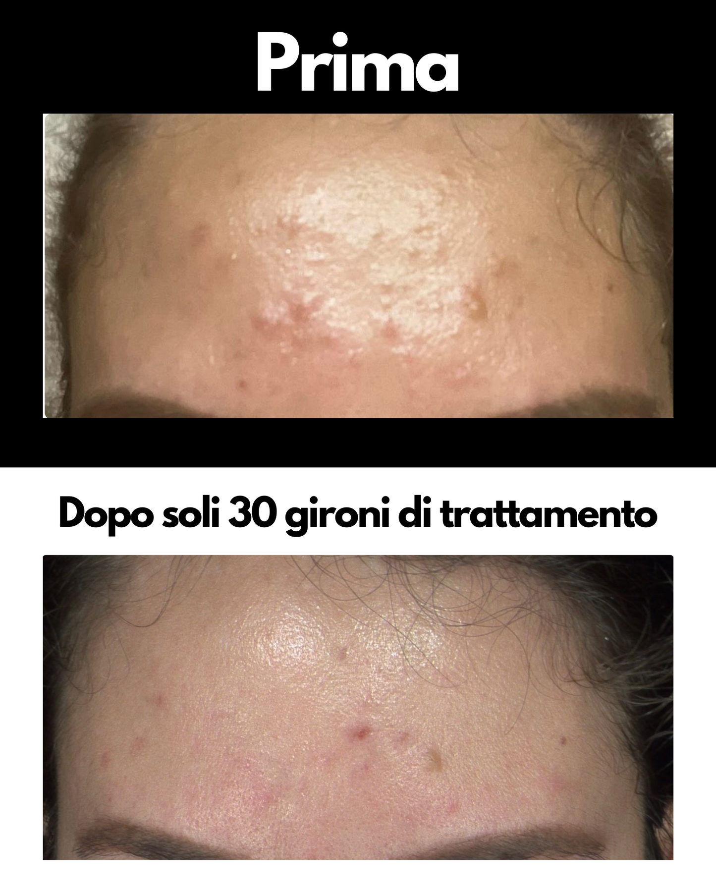 KIT PEARL-PURIFY SIERO VISO PERFEZIONATORE + PEARL-SCRUB